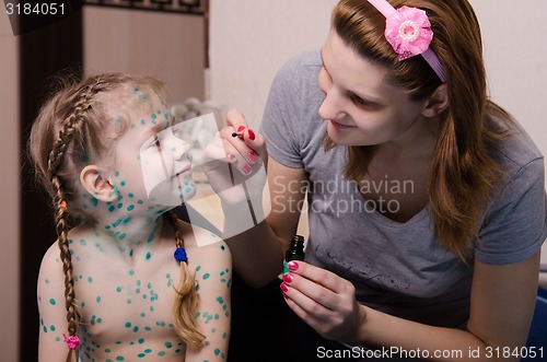 Image of Mama misses the child with chickenpox sores zelenkoj