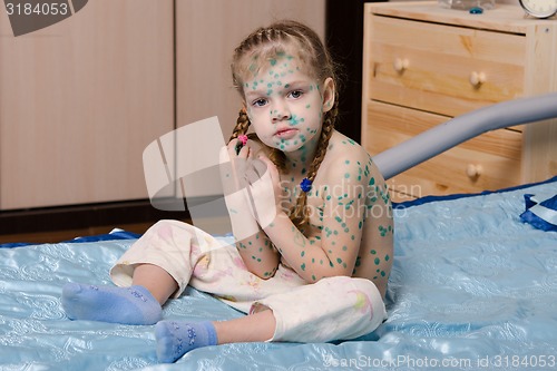 Image of Little girl covered with green traces of chickenpox sitting on bed