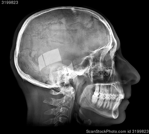 Image of Human skull X-ray image