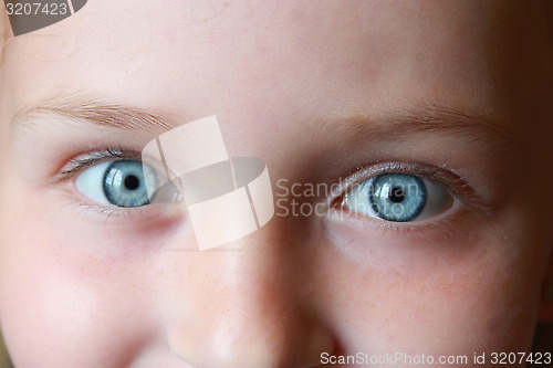 Image of teen's blue eyes staring up