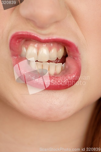 Image of Woman's teeth