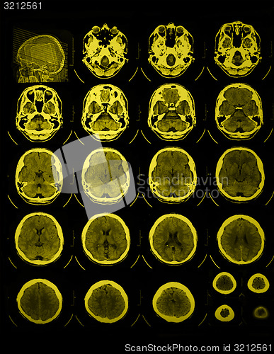 Image of CT and MRI of the skull