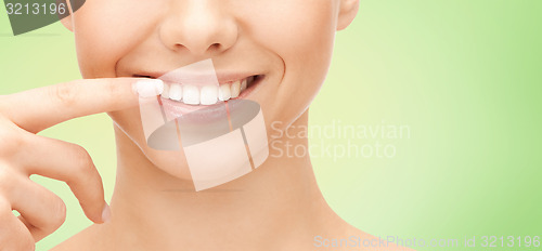 Image of close up of smiling woman face pointing to teeth
