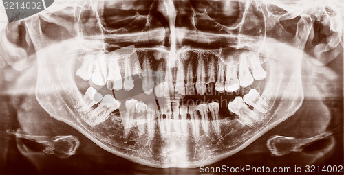 Image of Retro look Medical Xray