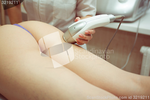 Image of procedure