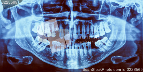 Image of Retro look Medical Xray