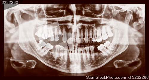 Image of Retro look Medical Xray