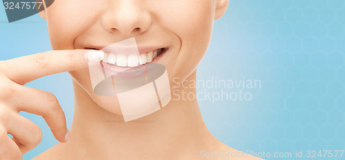 Image of close up of smiling woman face pointing to teeth