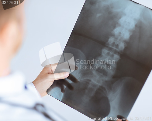 Image of doctor holding x-ray or roentgen image