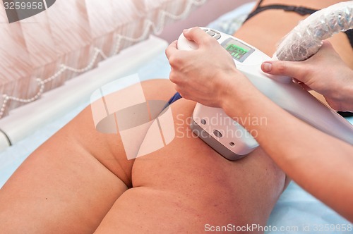Image of procedure
