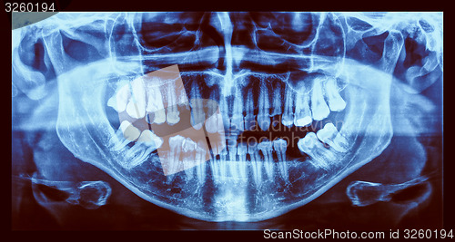 Image of Retro look Medical Xray
