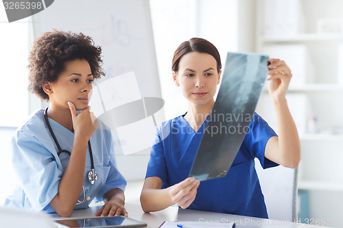 Image of female doctors with x-ray image at hospital