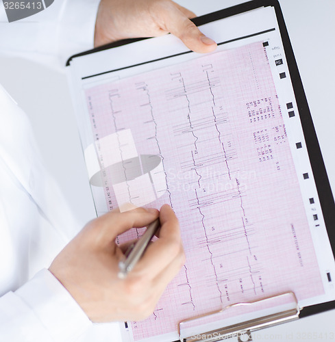 Image of male doctor hands with cardiogram