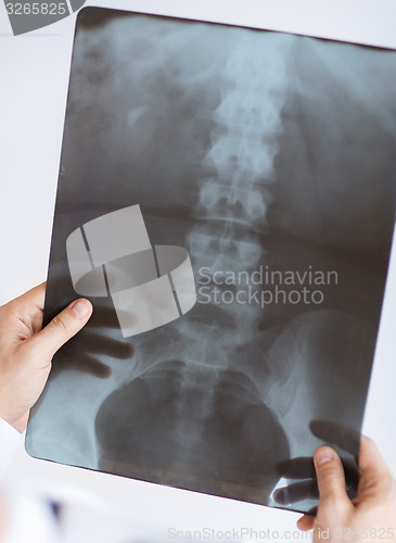 Image of doctor holding x-ray or roentgen image