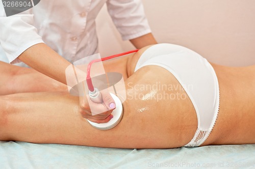 Image of procedure