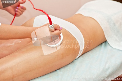 Image of procedure