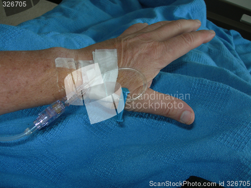 Image of intravenous feed in wrist