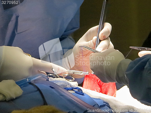 Image of Stomach Suturing