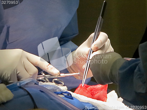 Image of Stomach Suturing