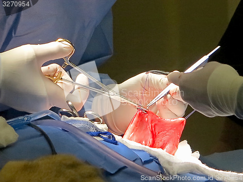 Image of Stomach Suturing