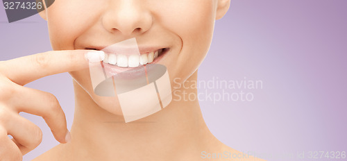 Image of close up of smiling woman face pointing to teeth