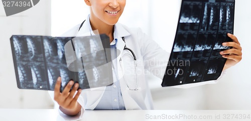 Image of african doctor looking at x-ray