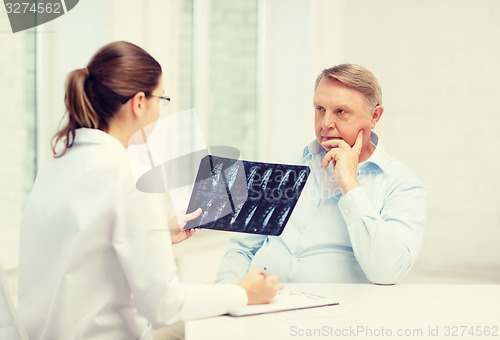 Image of female doctor with old man looking at x-ray