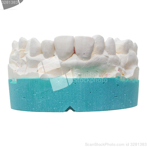Image of Positive teeth cast