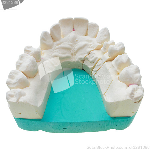 Image of Positive teeth cast