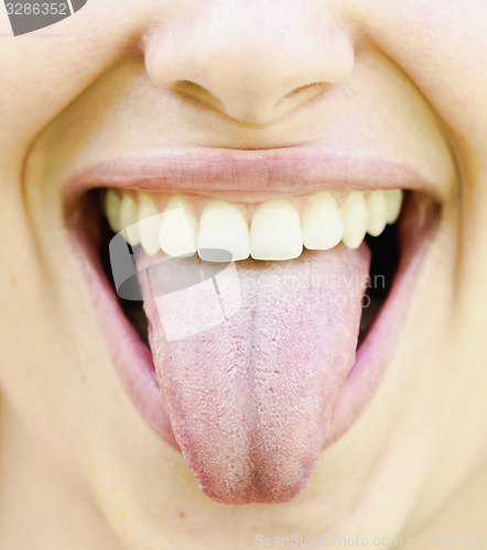 Image of healthy tongue