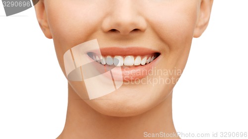 Image of teeth whitening, before and after