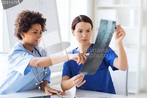 Image of female doctors with x-ray image at hospital