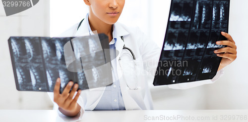 Image of african doctor looking at x-rays