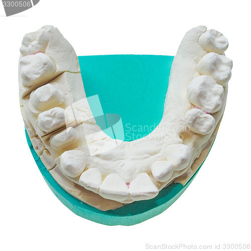 Image of Positive teeth cast