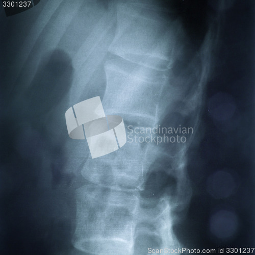 Image of X-ray