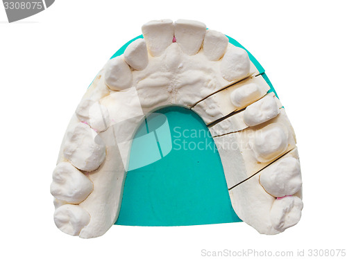Image of Positive teeth cast