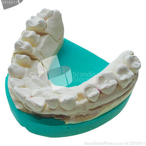 Image of Positive teeth cast