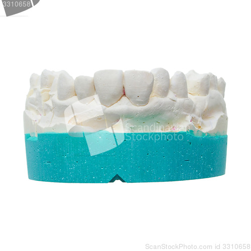 Image of Positive teeth cast