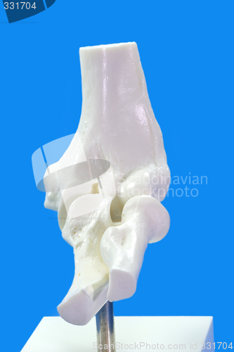 Image of  Elbow