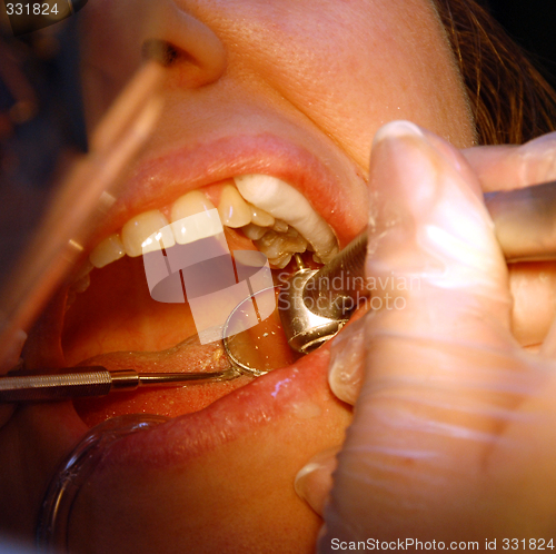 Image of Patient in the dental clinic