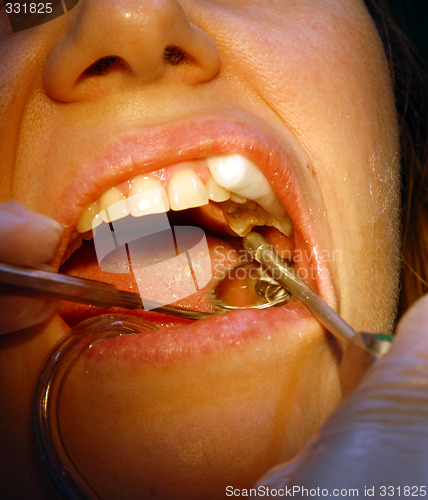 Image of Patient in the dental clinic