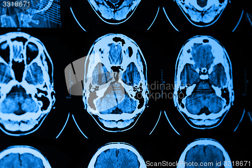 Image of CT and MRI of the skull