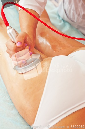 Image of procedure