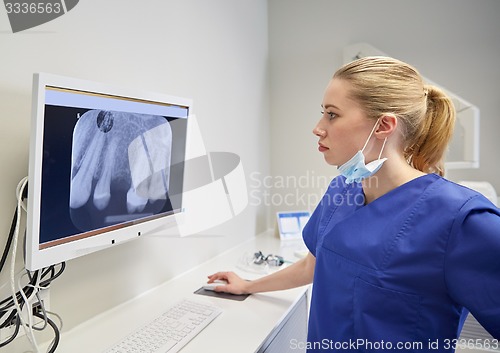 Image of dentist with x-ray on monitor at dental clinic