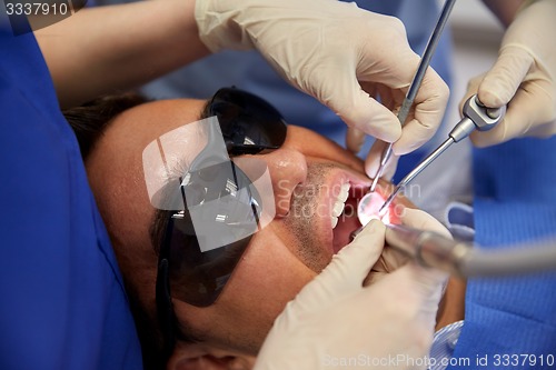 Image of dentist hands treating male patient teeth