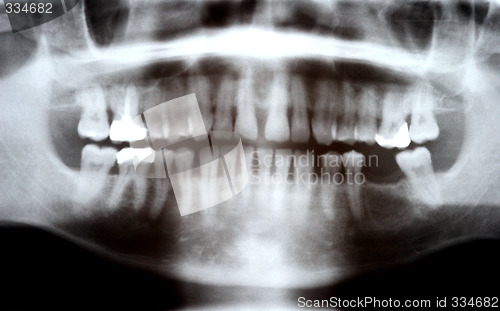 Image of X-ray photograph