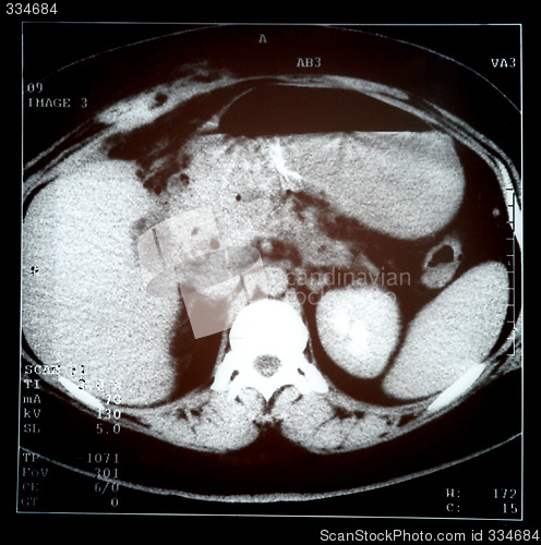 Image of Sonograph