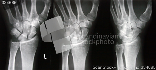 Image of X-ray photograph