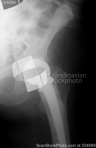 Image of X-ray photograph