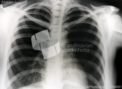 Image of X-ray photograph